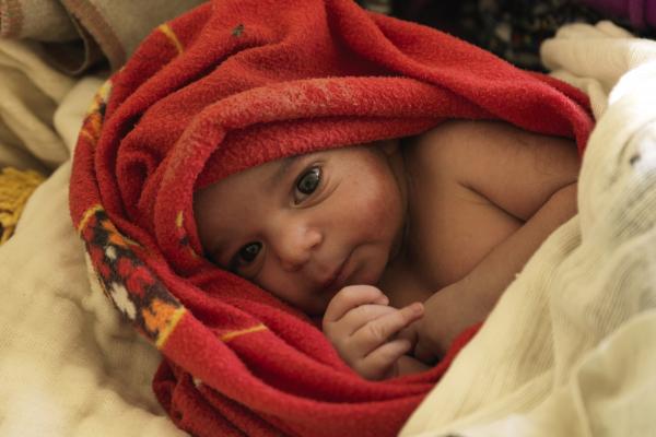 Baby in Ethiopia